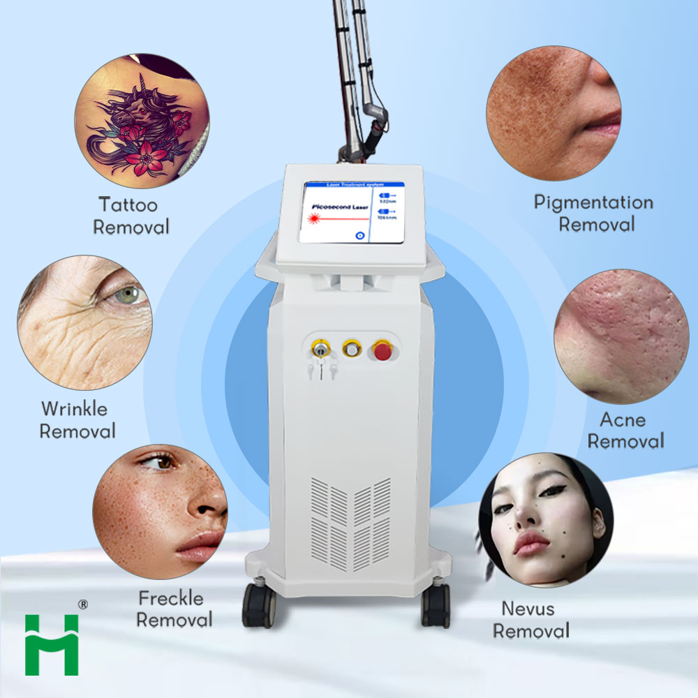 Nd Yag Laser Tattoo Removal Machine Q Switched Carbon Peeling 532nm 1064nm 1320nm