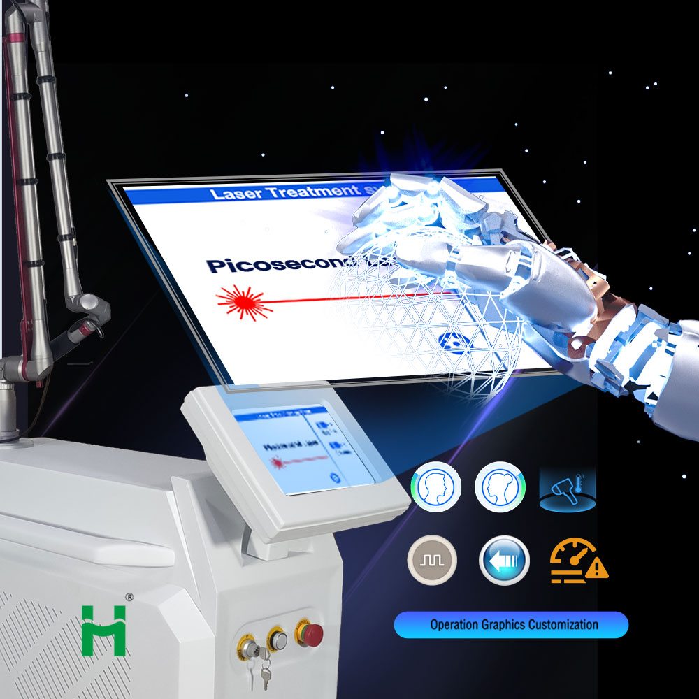 Nd Yag Laser Tattoo Removal Machine Q Switched Carbon Peeling 532nm 1064nm 1320nm