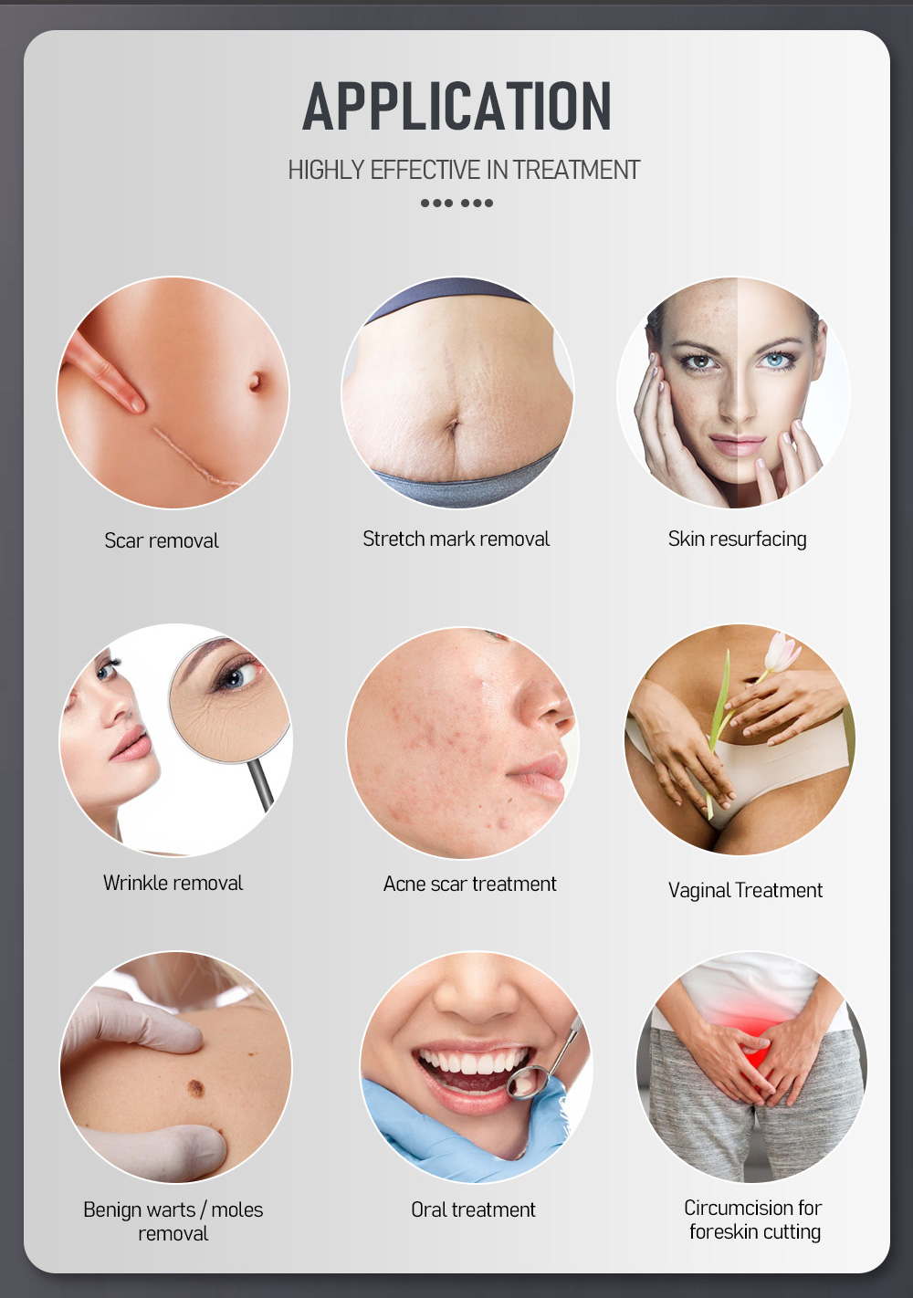 MDR HOT selling CO2 laser