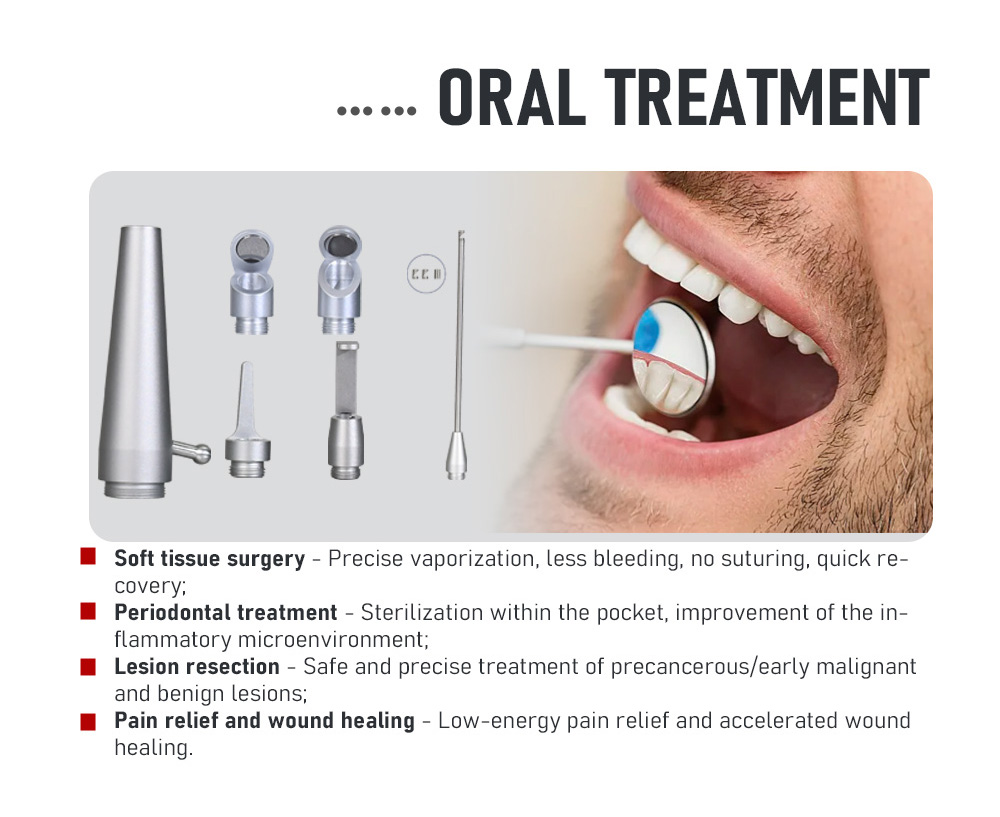 MDR HOT selling CO2 laser