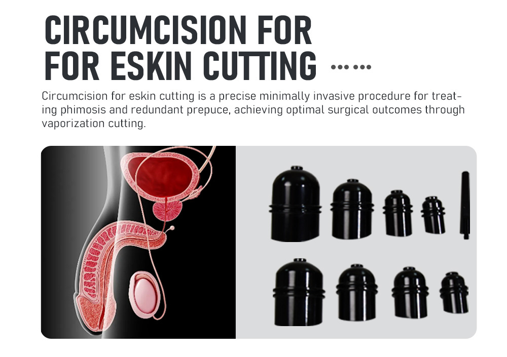 MDR HOT selling CO2 laser