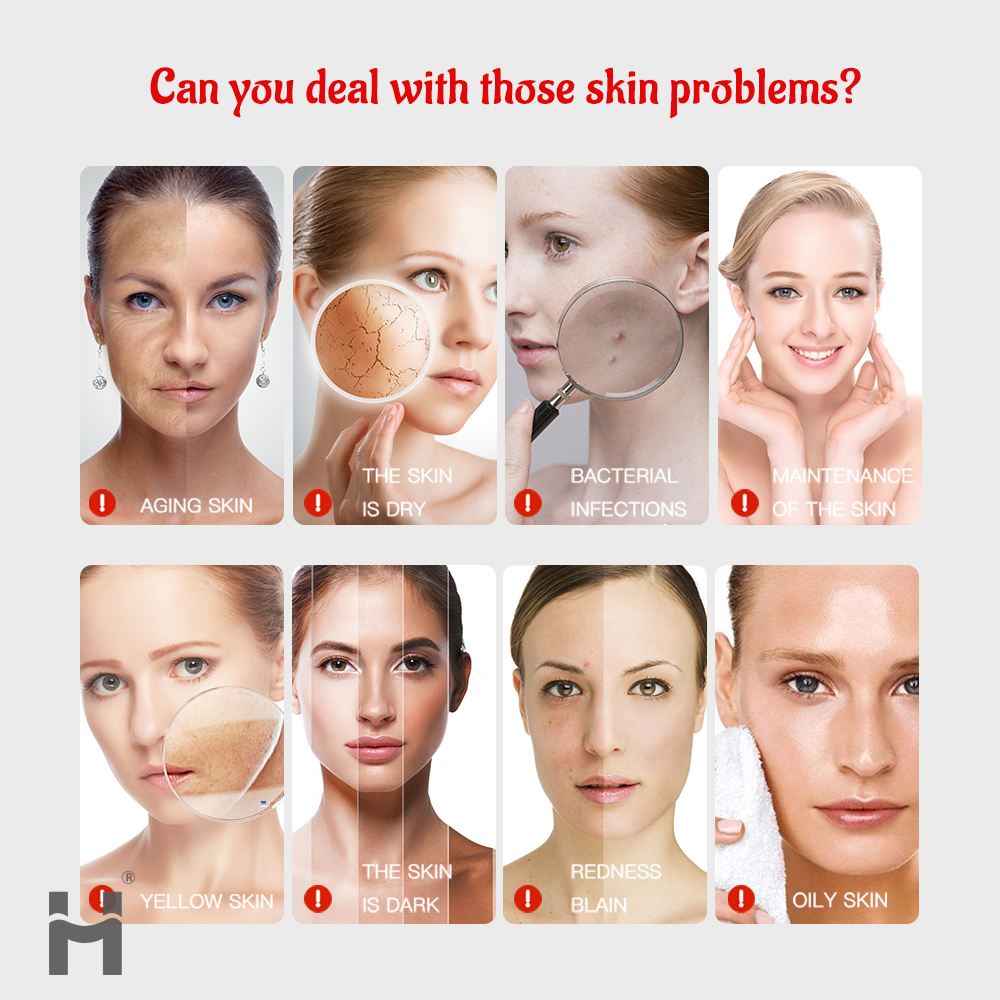 HOT selling MDR PDT LASER